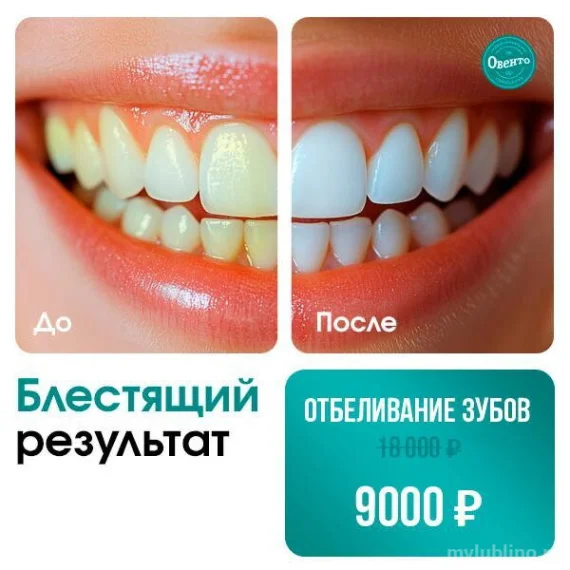 Отбеливание зубов со скидкой 50%